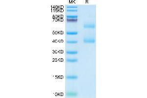 Mouse MEPE on Tris-Bis PAGE under reduced condition. (MEPE Protein (AA 25-441) (His tag))