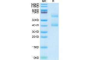 Mouse MEPE on Tris-Bis PAGE under reduced condition. (MEPE Protein (AA 25-441) (His tag))