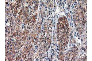 Immunohistochemistry (IHC) image for anti-Calpain 9 (CAPN9) antibody (ABIN1497092)