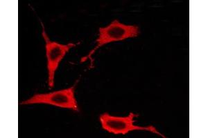 ABIN6267259 staining BT-20 cells by ICC/IF. (EGFR 抗体  (pThr693))