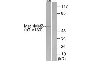 Western blot analysis of extracts from 293 cells, treated with H2O2 (100uM, 15 mins), using Mst1/2 (Phospho-Thr183) antibody. (MST1/MST2 (pThr183) 抗体)
