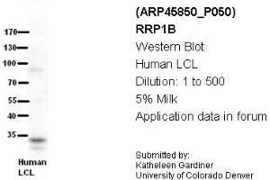 Image no. 2 for anti-Ribosomal RNA Processing 1 Homolog B (RRP1B) (Middle Region) antibody (ABIN2782382) (RRP1B 抗体  (Middle Region))