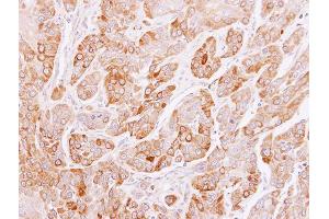 IHC-P Image Immunohistochemical analysis of paraffin-embedded SCC4 xenograft, using PEF1, antibody at 1:100 dilution. (PEF1 抗体)