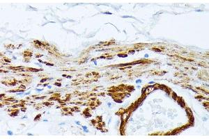 Immunohistochemistry of paraffin-embedded Human stomach using TPM2 Polyclonal Antibody at dilution of 1:100 (40x lens). (TPM2 抗体)