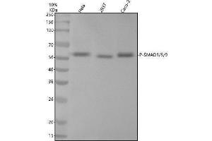 Western blot analysis of P-SMAD1/5/9 using anti-P-SMAD1/5/9 antibody (ABIN7603335).
