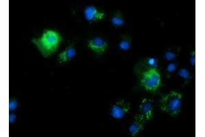 Anti-CALCOCO2 mouse monoclonal antibody (ABIN2453950) immunofluorescent staining of COS7 cells transiently transfected by pCMV6-ENTRY CALCOCO2 (RC203843). (CALCOCO2 抗体)