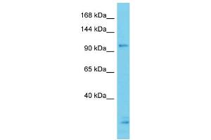 Host: Rabbit Target Name: CCDC132 Sample Type: ACHN Whole cell lysates Antibody Dilution: 1. (Syndetin/VPS50 抗体  (N-Term))