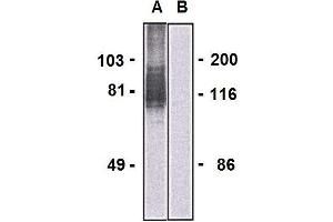 Western blotting analysis of LARGE1 in HEK293-LARGE1 transfectants (A) and HEK293 cells (B) using mouse monoclonal antibody (clone LARGE-02). (LARGE1 (AA 35-142) 抗体 (PE))