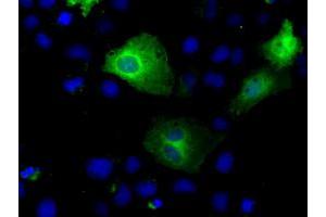 Immunofluorescence (IF) image for anti-Tubulin tyrosine Ligase-Like Family, Member 12 (TTLL12) antibody (ABIN1499032) (TTLL12 抗体)