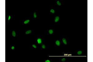Immunofluorescence of monoclonal antibody to HDAC1 on HeLa cell. (HDAC1 抗体  (AA 1-482))