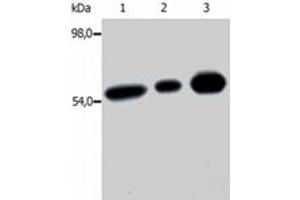 Immunoprecipitation of FYN from the lysate of T cells isolated from fresh buffy coats. (FYN 抗体  (AA 7-176))