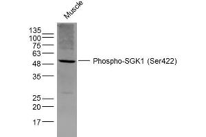 Mouse Muscle lysates probed with SGK1 (Ser422) Polyclonal Antibody, Unconjugated  at 1:300 dilution and 4˚C overnight incubation. (SGK1 抗体  (pSer422))