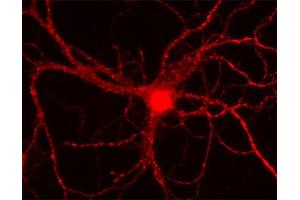 Indirect immunostaining of rat hippocampus neurons (dilution 1 : 500). (CAMK1 抗体)