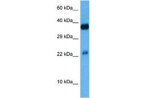 Host:  Mouse  Target Name:  CREB1  Sample Tissue:  Mouse Kidney  Antibody Dilution:  1ug/ml (CREM 抗体  (C-Term))