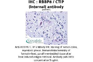 Image no. 2 for anti-Retinoblastoma Binding Protein 8 (RBBP8) (Internal Region) antibody (ABIN1738768) (Retinoblastoma Binding Protein 8 抗体  (Internal Region))