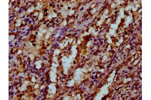 IHC image of ABIN7175529 diluted at 1:200 and staining in paraffin-embedded human lung tissue performed on a Leica BondTM system. (VKORC1 抗体  (AA 30-74))