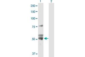 Western Blotting (WB) image for anti-ATP Synthase, H+ Transporting, Mitochondrial F1 Complex, beta Polypeptide (ATP5B) (AA 1-529) antibody (ABIN513616)