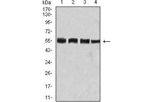 Western Blotting (WB) image for anti-Bridging Integrator 1 (BIN1) (AA 189-398) antibody (ABIN5858685) (BIN1 抗体  (AA 189-398))