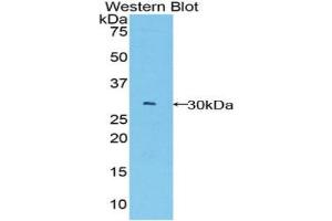 Western blot analysis of the recombinant protein. (BCL3 抗体  (AA 127-376))
