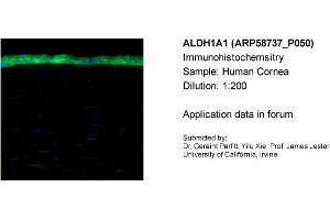 Sample Type: Human CorneaDilution: 1:200 (ALDH1A1 抗体  (Middle Region))