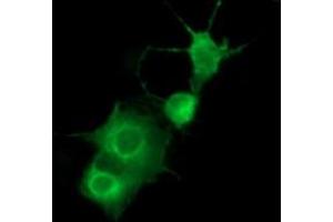 Image no. 3 for anti-Platelet Derived Growth Factor Receptor beta (PDGFRB) antibody (ABIN1500102) (PDGFRB 抗体)