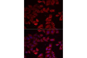 Immunofluorescence analysis of HeLa cells using SEPHS1 antibody (ABIN5973853). (SEPHS1 抗体)