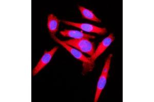 IF analysis of KLC1 using anti-KLC1 antibody (ABIN7599469). (KLC1 抗体  (AA 1-537))
