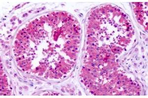 Immunohistochemistry (IHC) image for anti-Solute Carrier Family 1 (Glutamate/Neutral Amino Acid Transporter), Member 4 (SLC1A4) (N-Term) antibody (ABIN1049334)