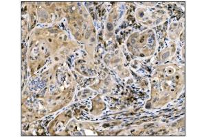 IHC analysis of Caspase-9/CASP9 using anti-Caspase-9/CASP9 antibody (ABIN7600340).