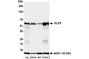 Western Blotting (WB) image for anti-Kruppel-Like Factor 5 (Intestinal) (KLF5) (AA 325-375) antibody (ABIN7795630) (Recombinant KLF5 抗体  (AA 325-375))