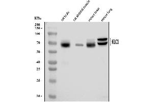 Western blot analysis of KLC1 using anti-KLC1 antibody (ABIN7599469). (KLC1 抗体  (AA 1-537))