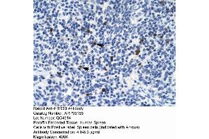 Rabbit Anti-HTR3B Antibody  Paraffin Embedded Tissue: Human Spleen Cellular Data: Spleen cells Antibody Concentration: 4. (Serotonin Receptor 3B 抗体  (N-Term))