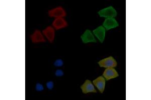 ABIN7096961 and ABIN7101028 staining Hela cells(30 min of UV treatment) by IF/ICC. (NIPA2 抗体)