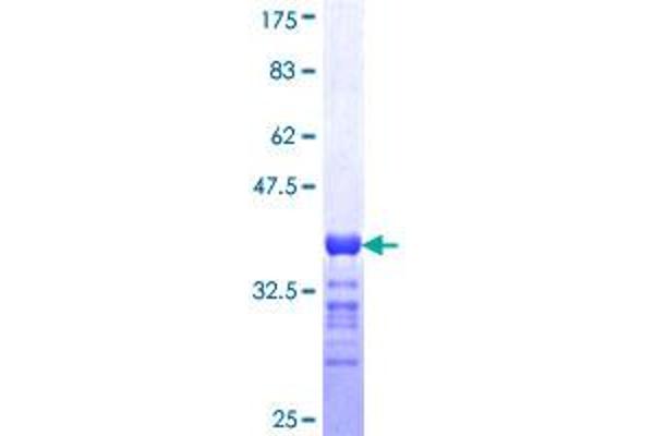 RIMS2 Protein (AA 181-260) (GST tag)