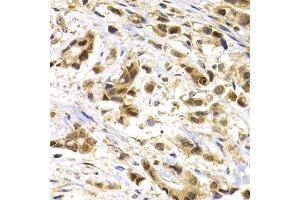 Immunohistochemistry (IHC) image for anti-Melanoma Antigen Family A, 1 (Directs Expression of Antigen MZ2-E) (MAGEA1) (AA 1-309) antibody (ABIN6143435)