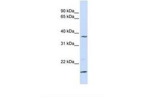 anti-Zinc Finger, DHHC-Type Containing 19 (ZDHHC19) (N-Term) antibody