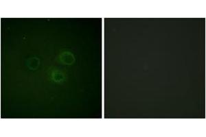 Immunofluorescence analysis of A549 cells, using CD226/DNAM-1 (Phospho-Ser329) Antibody. (CD226 抗体  (pSer329))