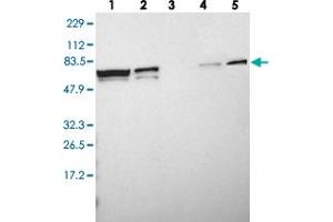 Western blot analysis of Lane 1: RT-4, Lane 2: U-251 MG, Lane 3: Human Plasma, Lane 4: Liver, Lane 5: Tonsil with MYEF2 polyclonal antibody  at 1:250-1:500 dilution. (MYEF2 抗体)
