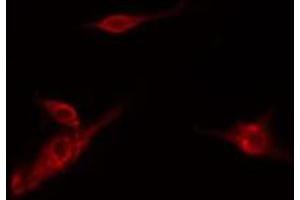 ABIN6278579 staining Hela cells by IF/ICC. (HK3 抗体  (Internal Region))