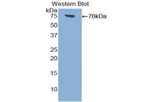 Western Blotting (WB) image for anti-Intercellular Adhesion Molecule 1 (ICAM1) (AA 26-480) antibody (ABIN1859239) (ICAM1 抗体  (AA 26-480))