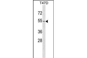 KRT79 Antibody (Center) (ABIN1538319 and ABIN2849265) western blot analysis in T47D cell line lysates (35 μg/lane). (Cytokeratin 79 抗体  (AA 331-357))
