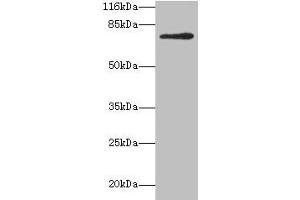 MTHFR 抗体  (AA 1-656)