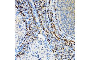 Immunohistochemistry of paraffin-embedded rat ovary using SRP19 antibody. (SRP19 抗体)