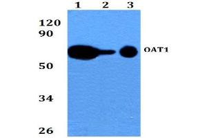 Western blot  analysis of SLC22A6 / OAT1 Antibody at 1/500 dilution. (SLC22A6 抗体)