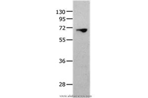 Western blot analysis of 823 cell, using MMP25 Polyclonal Antibody at dilution of 1:1300 (MMP25 抗体)