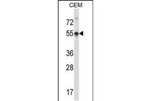 Western blot analysis in CEM cell line lysates (35ug/lane). (POU3F3 抗体  (AA 294-323))