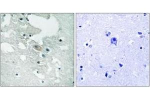 Immunohistochemistry analysis of paraffin-embedded human brain, using BLNK (Phospho-Tyr84) Antibody. (B-Cell Linker 抗体  (pTyr84))