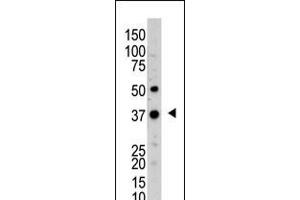 Antibody is used in Western blot to detect UCHL5 in mouse kidney tissue lysate.