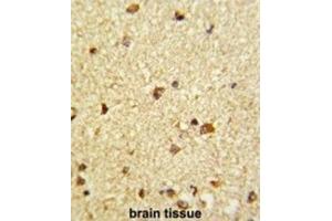 Immunohistochemistry (IHC) image for anti-Core-Binding Factor, beta Subunit (CBFB) antibody (ABIN3002868) (CBFB 抗体)