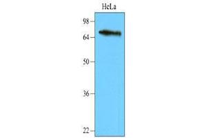 Cell lysates of HeLa (40 ug) were resolved by SDS-PAGE, transferred to nitrocellulose membrane and probed with anti-human NSD3 (1:2,000). (WHSC1L1 抗体  (AA 383-660))